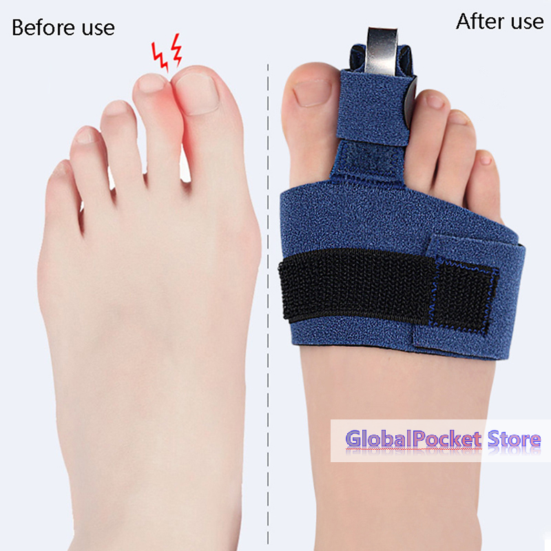 1Pcs Toe Corrector Toe Fractur - Ankle Brace Sock บทวิจารณ์และราคา